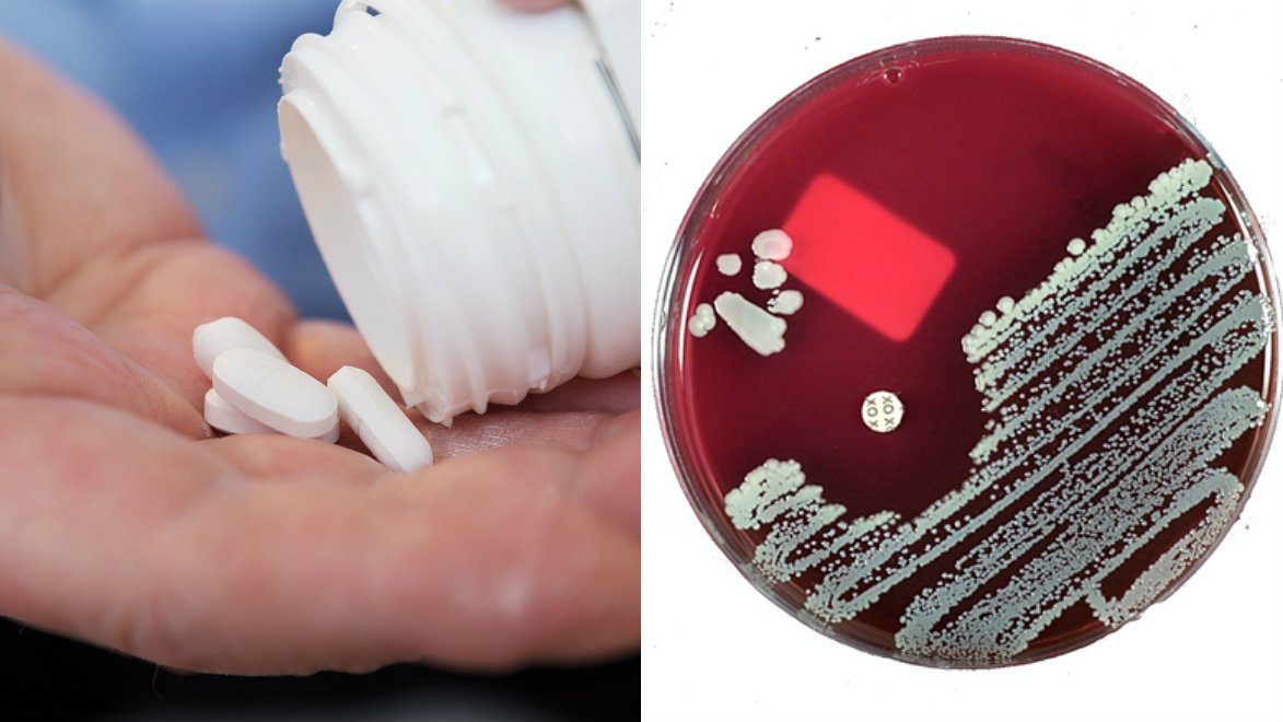 Användningen av antibiotika behöver minska ännu mer för att motverka resistenta bakterier.