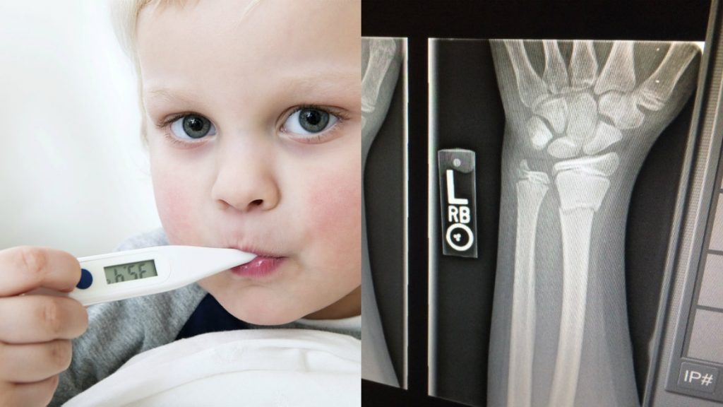 Pejke med febertermometer och röntgenbild av hand