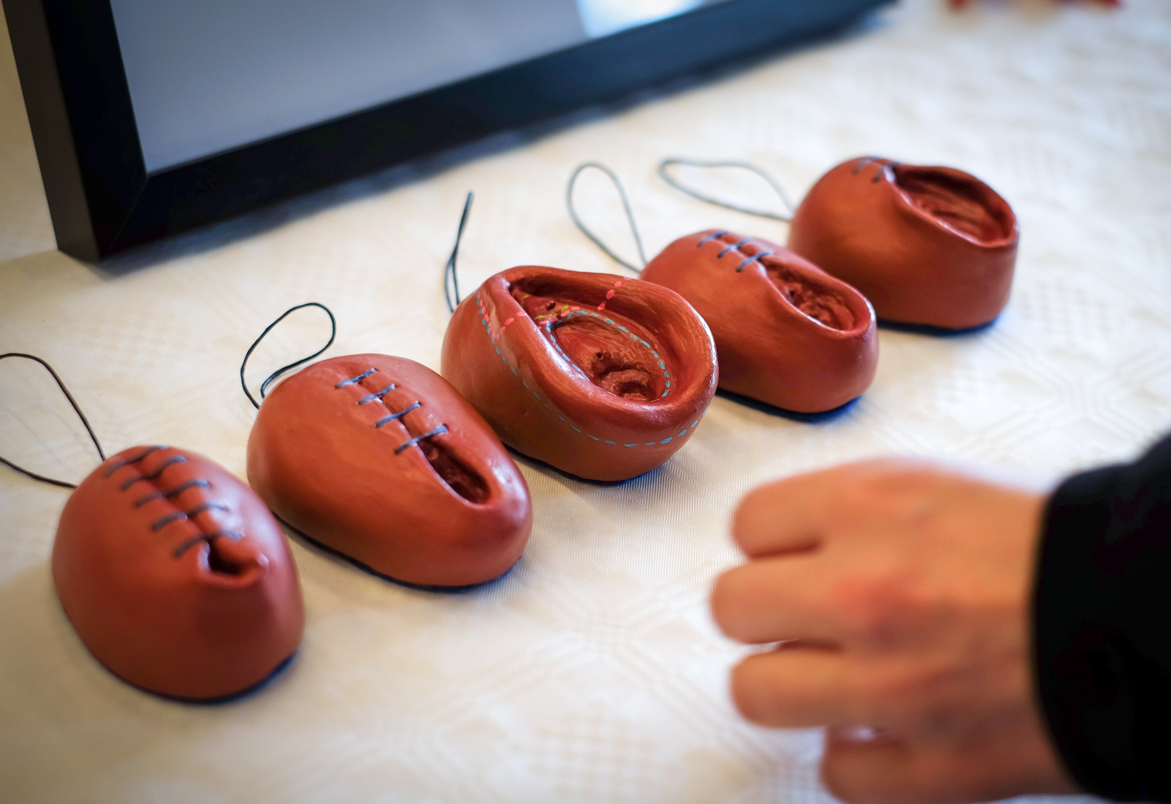 Modeller som visar olika former av kvinnlig könsstympning där man skadat eller tagit bort delar av könsorganet. Foto: Rebecca Landmér.