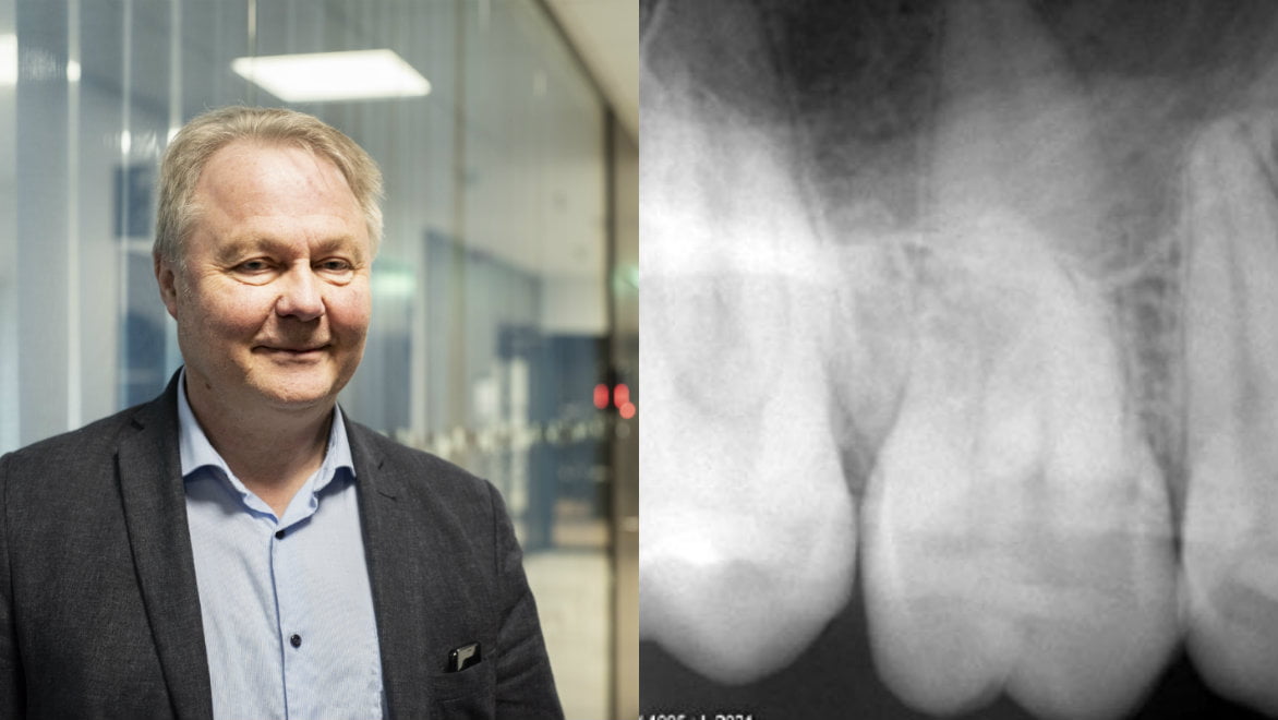 Utvecklingschef Bent Petersen